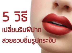 ฉีดฟิลเลอร์ปาก