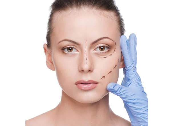 ร้อยไหมก้างปลา