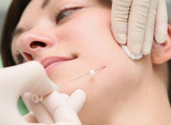 ร้อยไหมแบบไหน