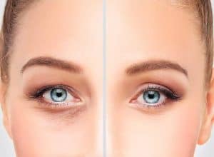 ฉีดโบท็อกซ์ ขอนแก่น , ฉีดฟีลเลอร์ ขอนแก่น , ร้อยไหม ขอนแก่น คลินิก ขอนแก่น , ผิวขาว ขอนแก่น