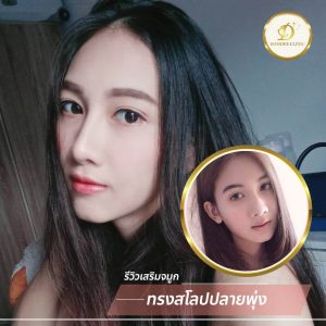 ทำจมูก ขอนแก่น