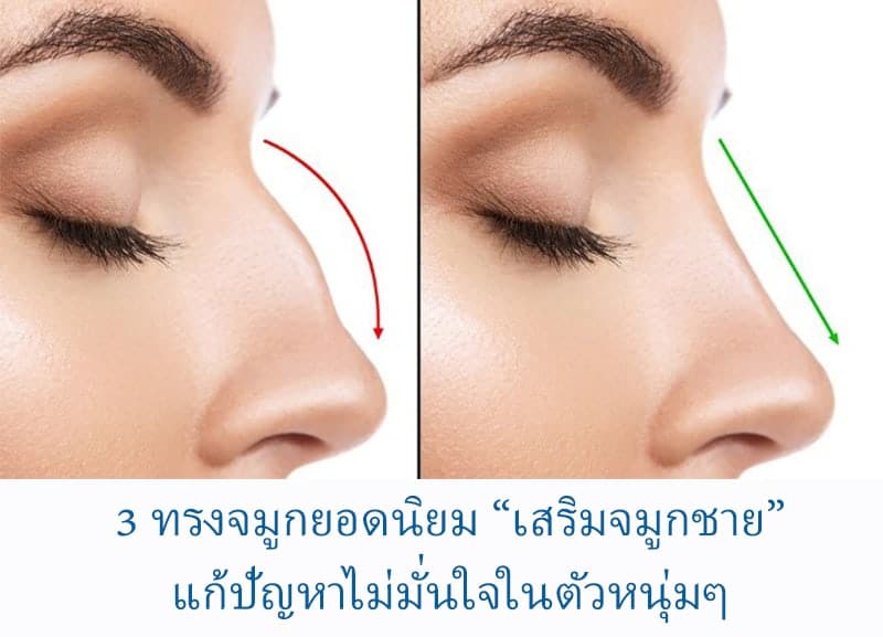 3 ทรงจมูกยอดนิยม “เสริมจมูกชาย” แก้ปัญหาไม่มั่นใจในตัวหนุ่มๆ - Wandeeclinic  วันดี คลินิกฉีดฟิลเลอร์ โบท็อเสริมจมูกที่ไหนดี ศัลยกรรม