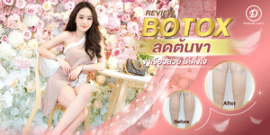 โบท็อกซ์ขอนแก่น