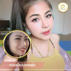 รีวิว จมูก