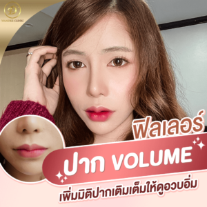 รีวิว ฟิลเลอร์ปาก