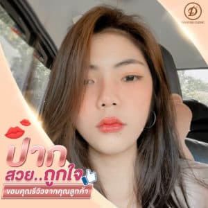 รีวิว ฟิลเลอร์ปาก