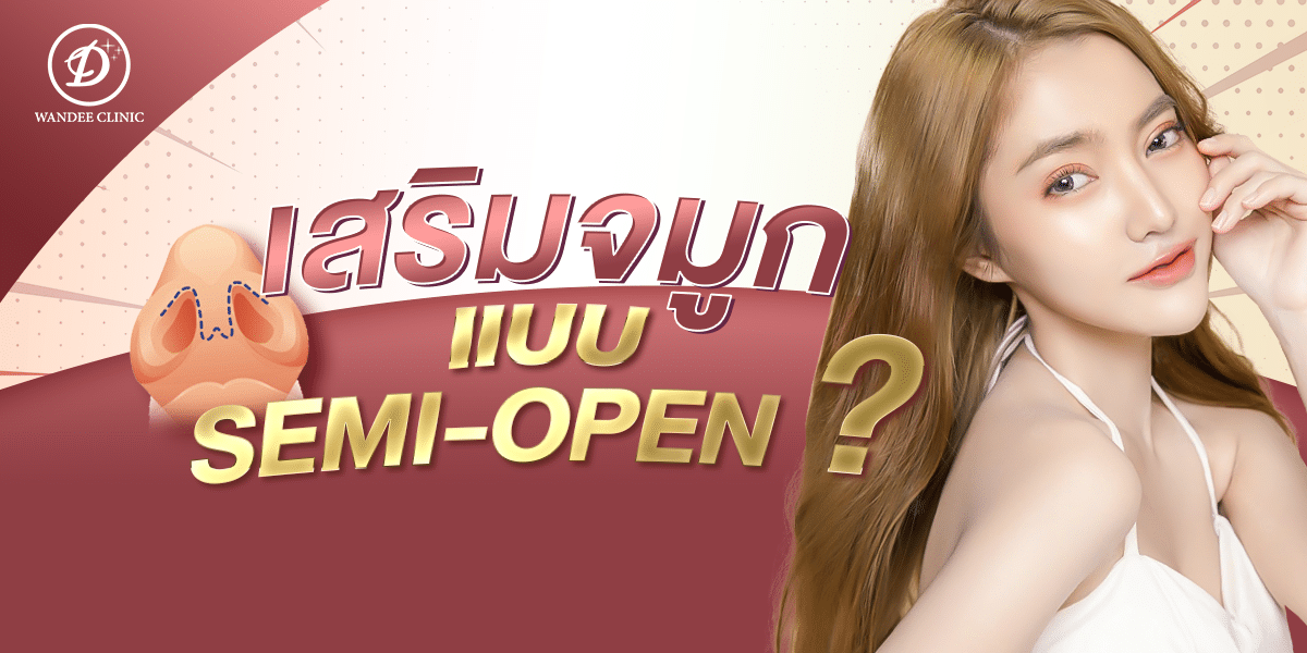 การเสริมจมูก