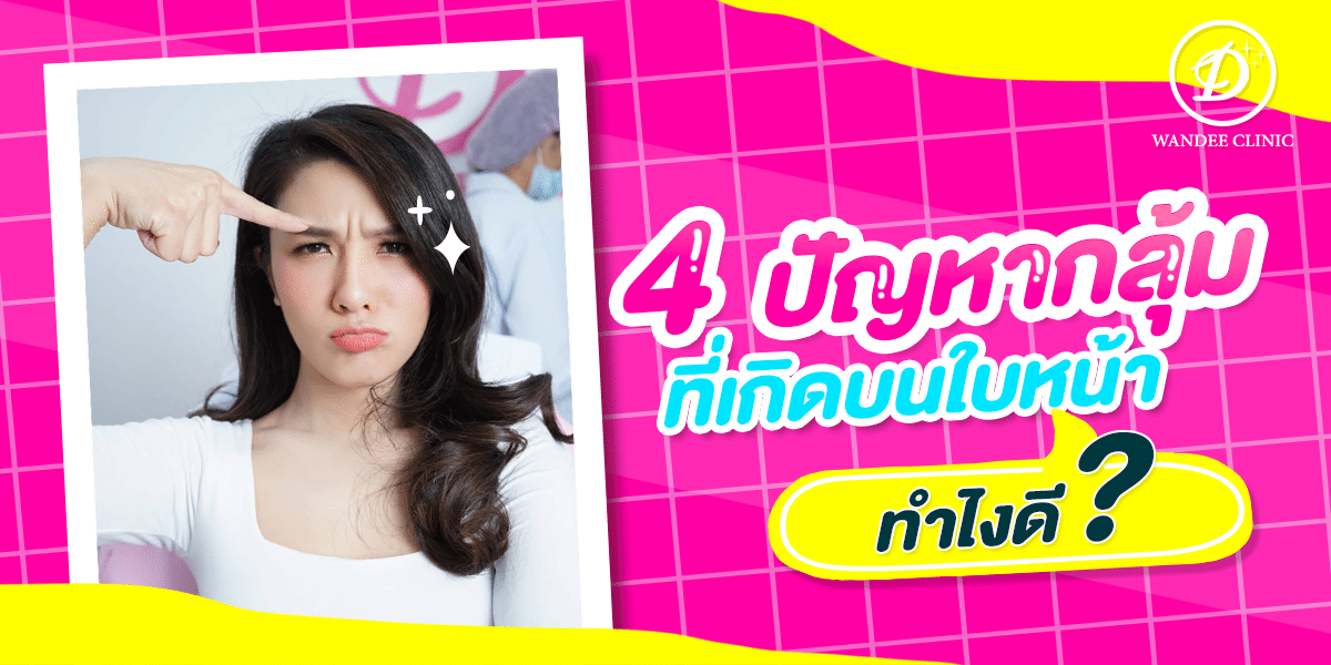 รีวิวโบท็อก 4 ปัญหากลุ้มบนใบหน้า