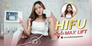 รีวิว HIFU Power