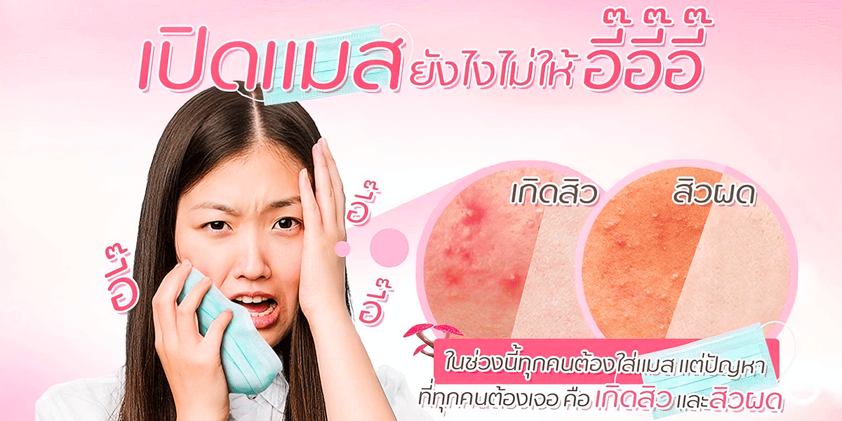 ใส่แมสแล้วสิวขึ้นแก้ยังไง