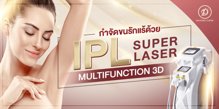 IPL รักแร้กี่ครั้งเห็นผล