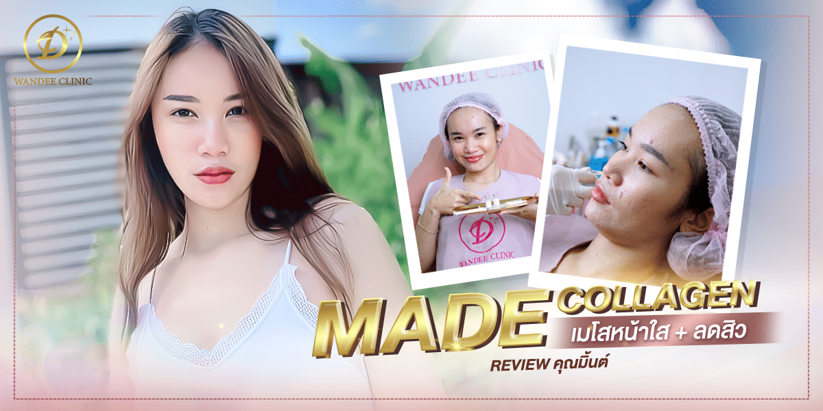 รีวิวฉีดหน้าใส Made