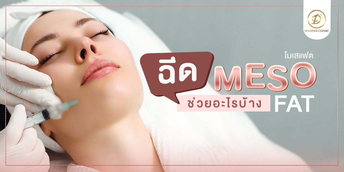 เมโสแฟตMesoFat
