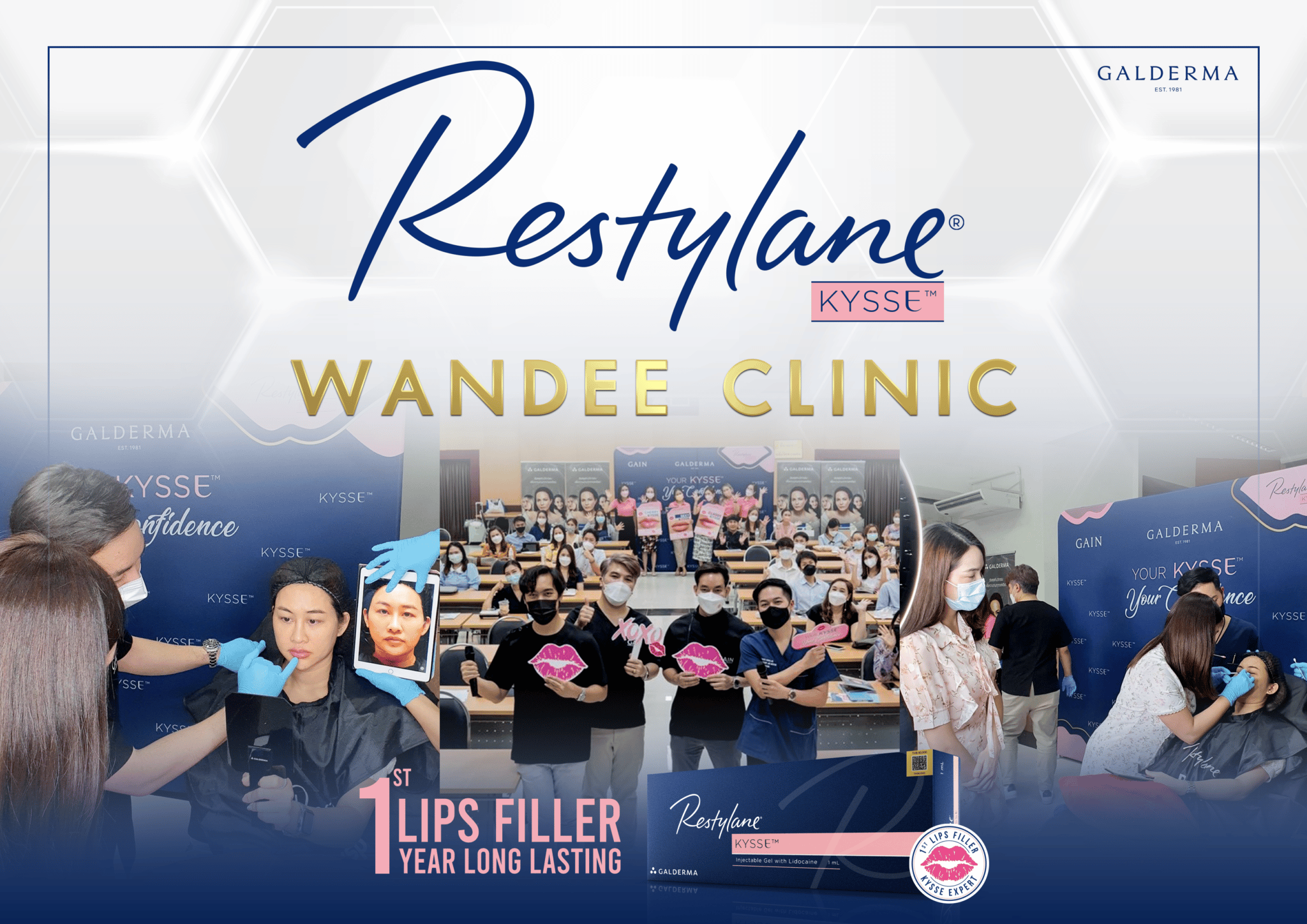 Restylane Filler