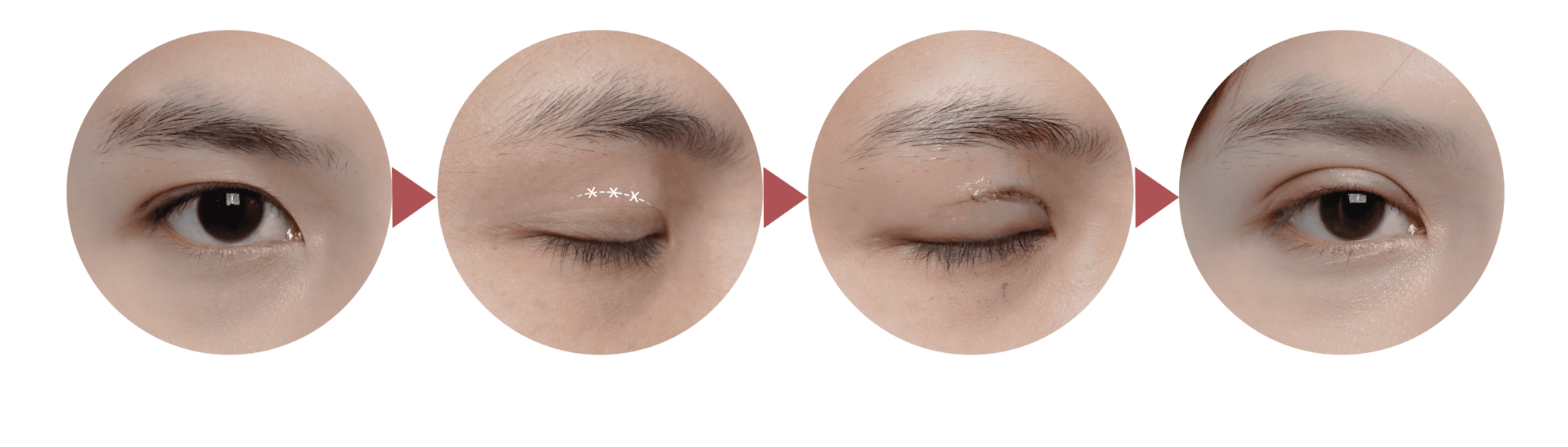 ตาสองชั้น