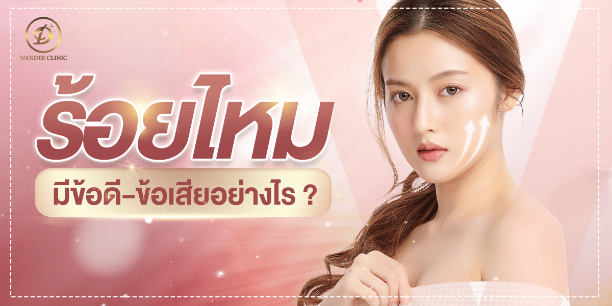 ร้อยไหม คืออะไร