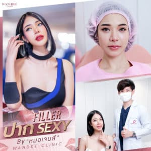 ฟิลเลอร์