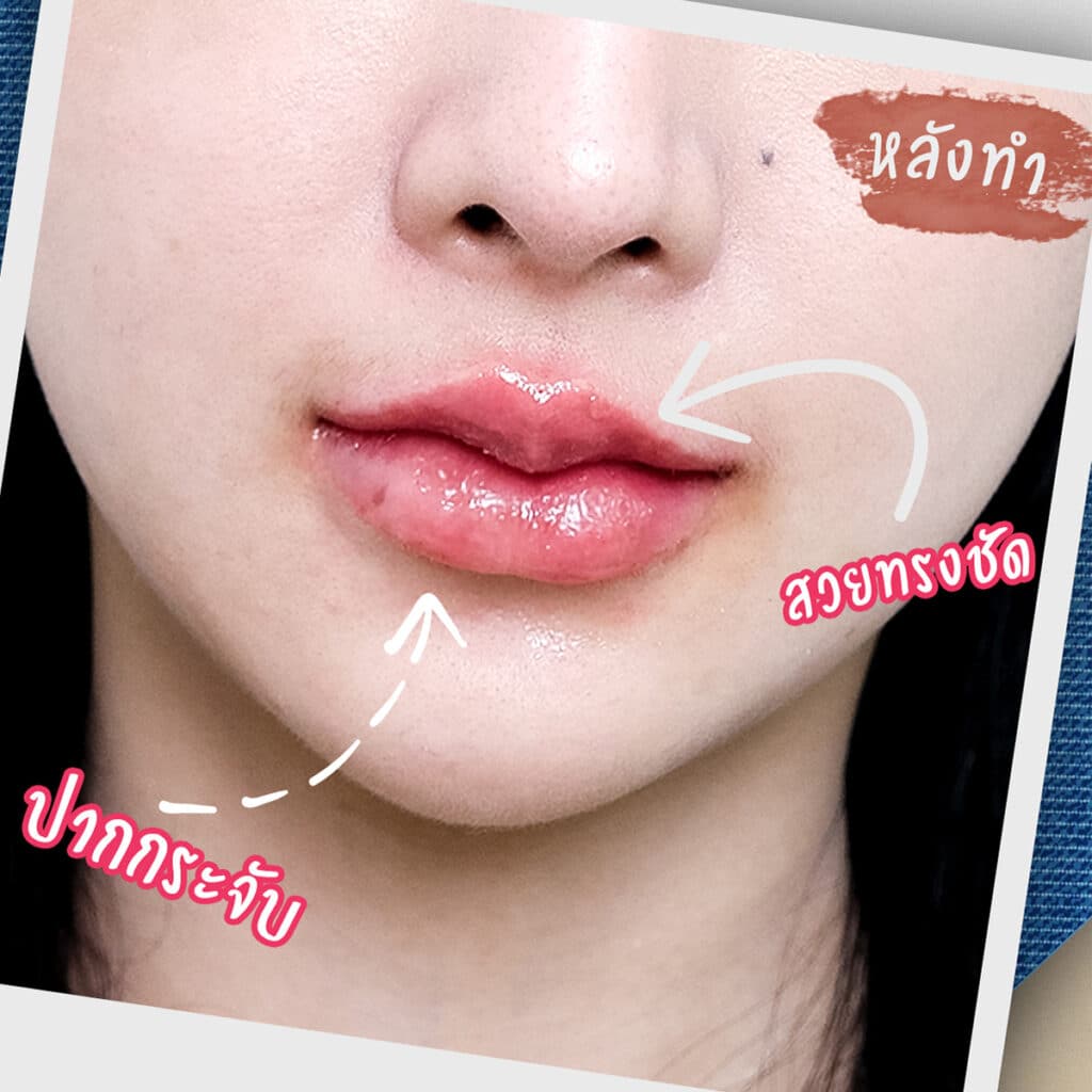 𝐅𝐢𝐥𝐥𝐞𝐫 ปาก สายฝอ