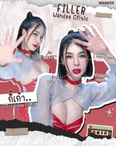 Filler แก้มตอบ