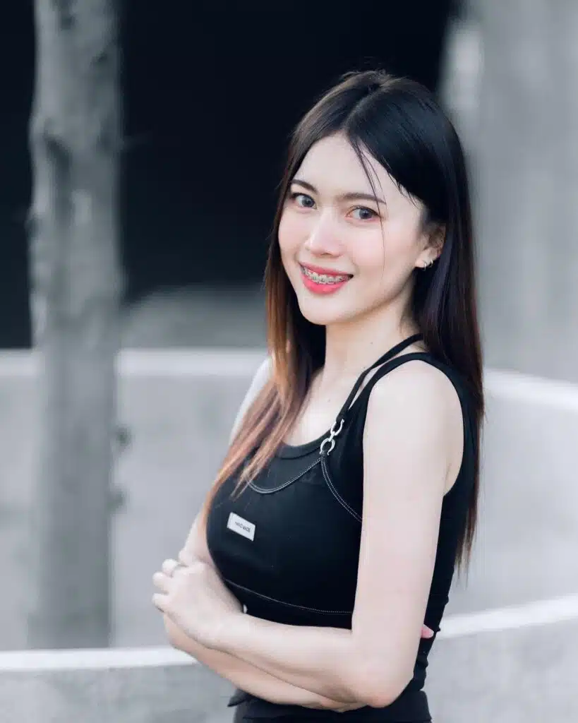รีวิว BOTOX ลดกราม