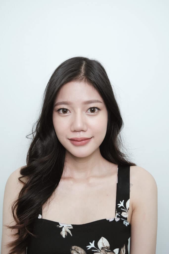 ฟิลเลอร์ ร่องแก้ม