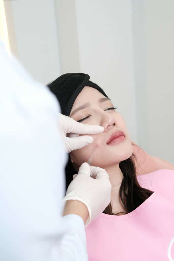 ฟิลเลอร์ ร่องแก้ม