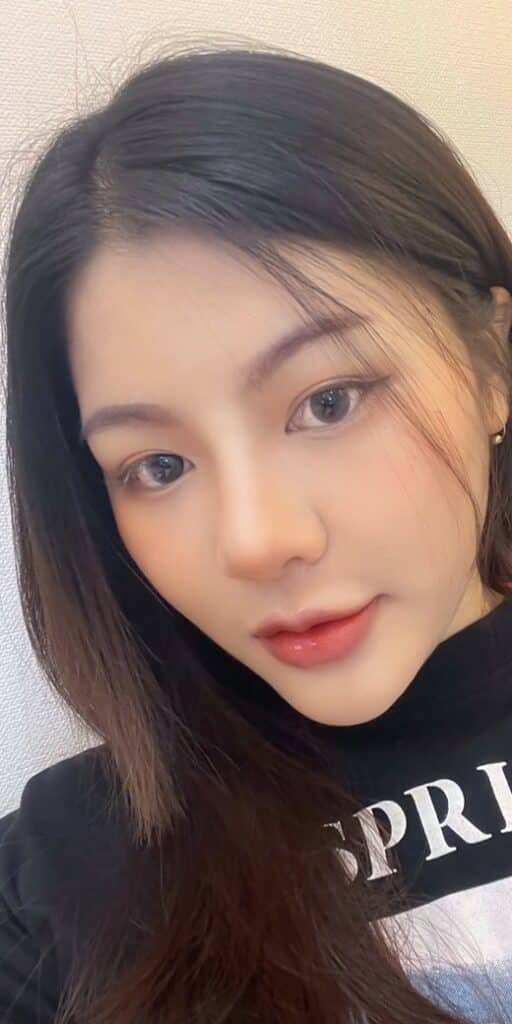 โบท็อกซ์