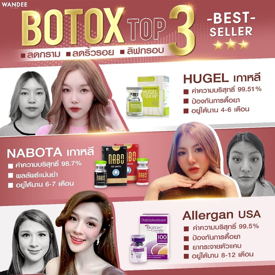 โบท็อกซ์