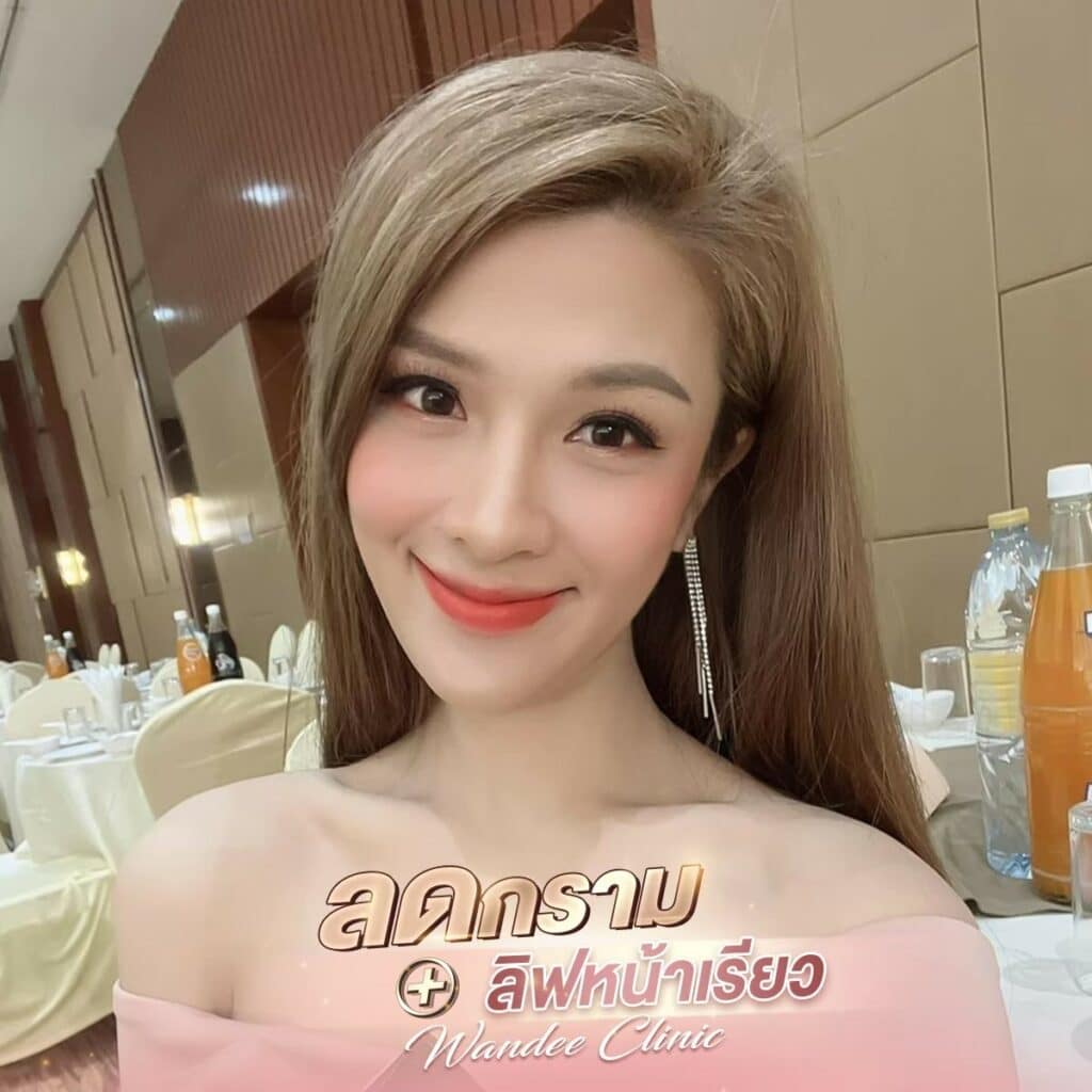 โบท็อกซ์