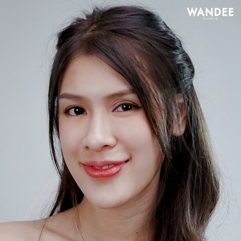 𝐅𝐢𝐥𝐥𝐞𝐫 ใบหน้า