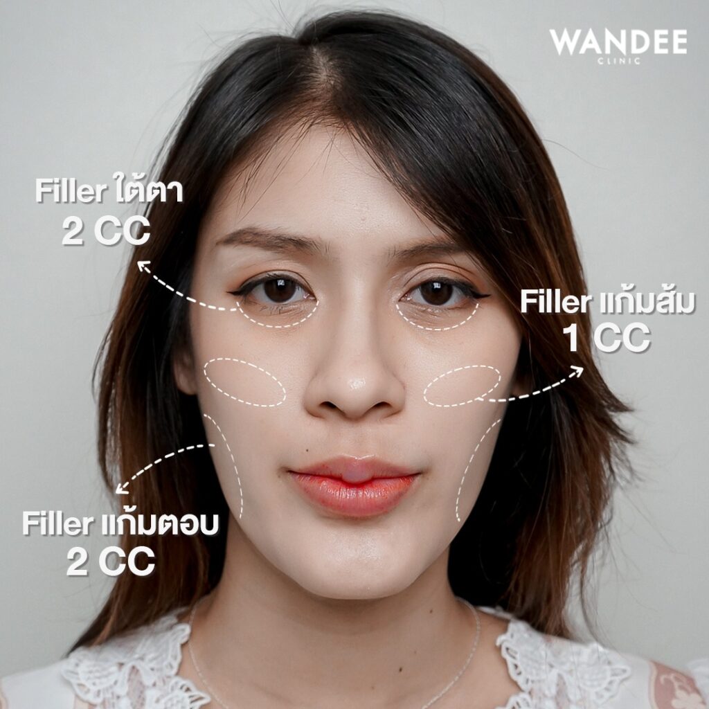 𝐅𝐢𝐥𝐥𝐞𝐫 ใบหน้า