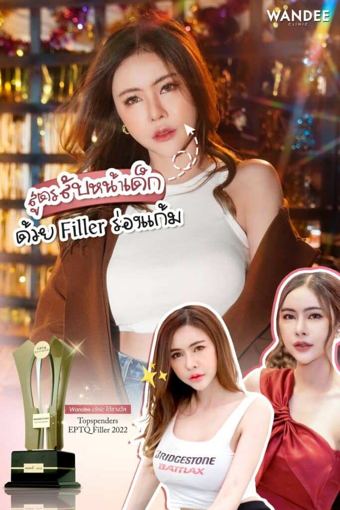 รีวิว Filler ร่องแก้ม