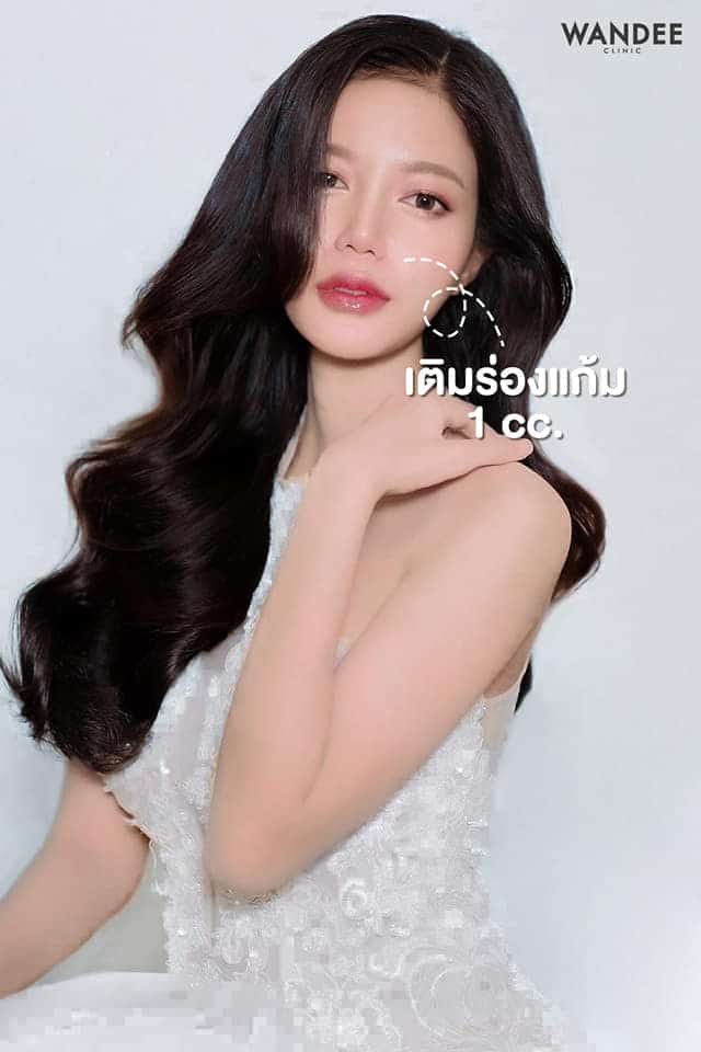 เติม 𝐅𝐢𝐥𝐥𝐞𝐫 ร่องแก้ม