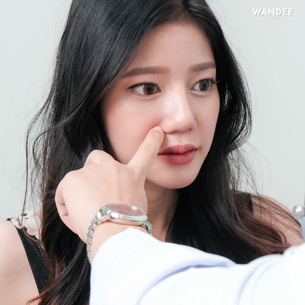 เติม 𝐅𝐢𝐥𝐥𝐞𝐫 ร่องแก้ม