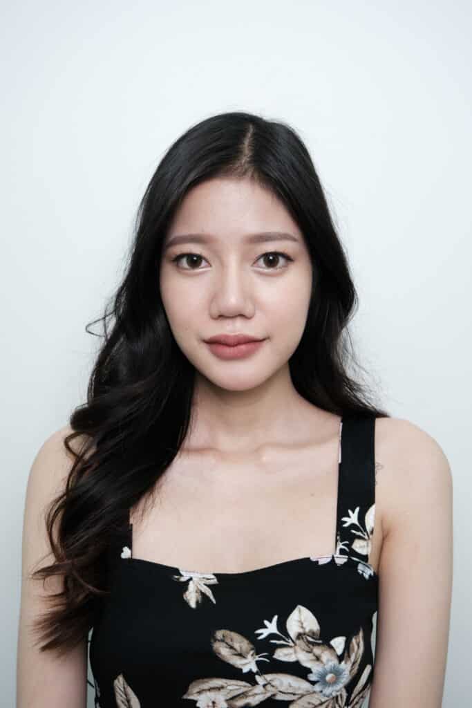 ฟิลเลอร์ ร่องแก้ม