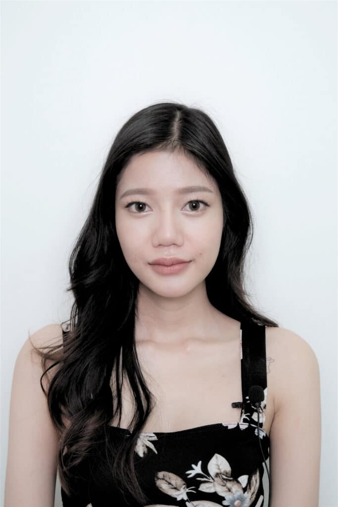 ฟิลเลอร์ ร่องแก้ม