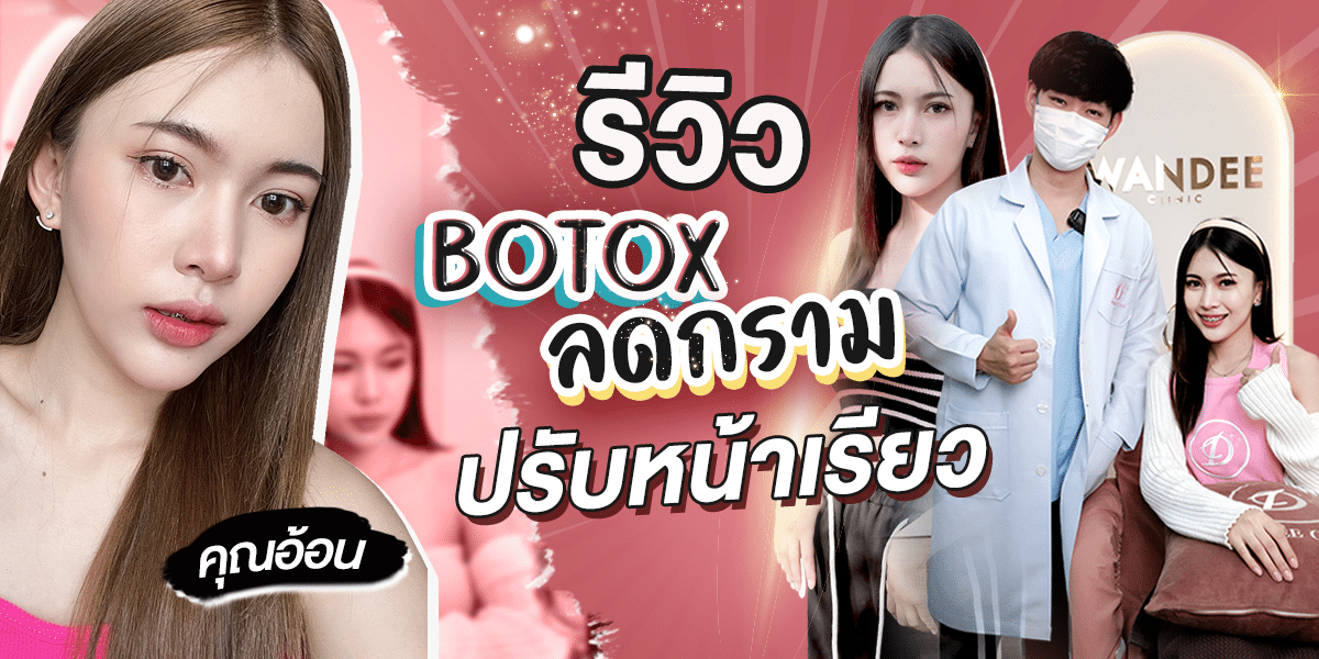 รีวิว BOTOX ลดกราม