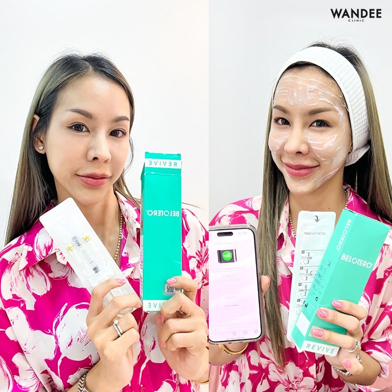 𝗕𝗘𝗟𝗢𝗧𝗘𝗥𝗢 หน้าเด็ก