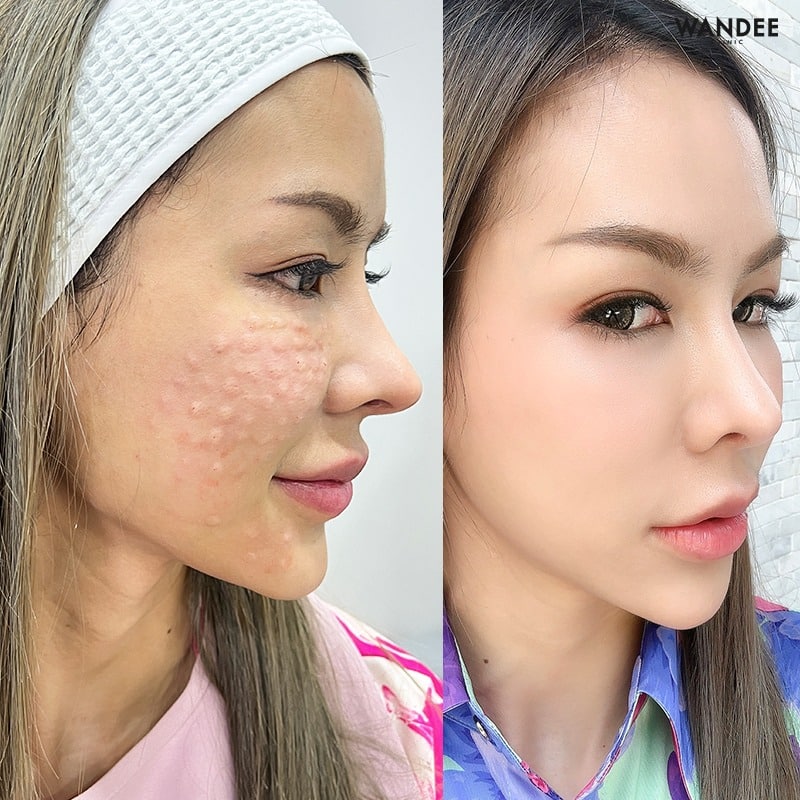 𝗕𝗘𝗟𝗢𝗧𝗘𝗥𝗢 หน้าเด็ก