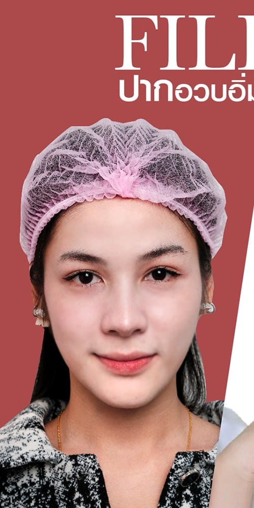 𝐅𝐢𝐥𝐥𝐞𝐫 ปากกระจับ