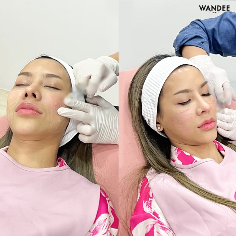 𝗕𝗘𝗟𝗢𝗧𝗘𝗥𝗢 หน้าเด็ก