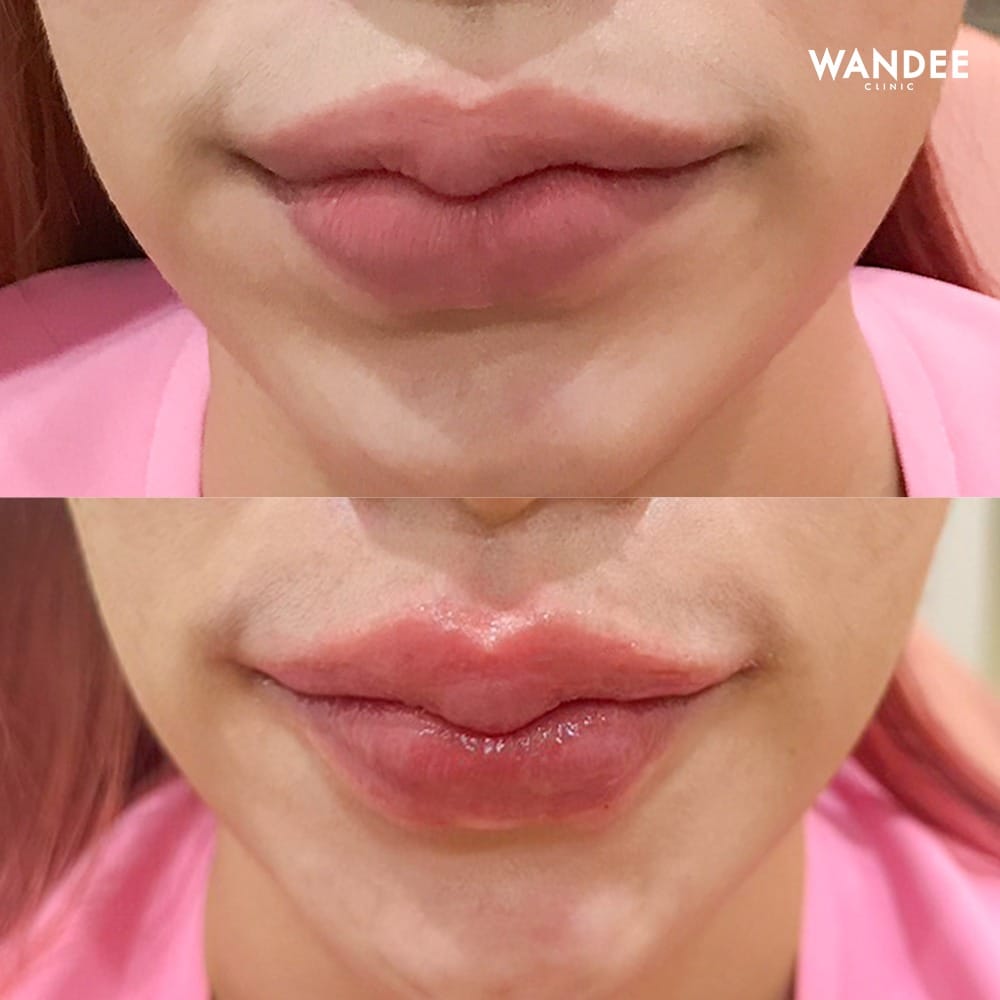 รีวิว 𝐅𝐢𝐥𝐥𝐞𝐫 ปากสวย