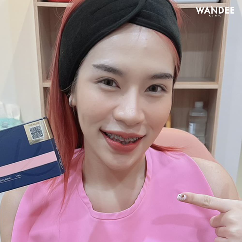 𝐅𝐢𝐥𝐥𝐞𝐫 ปากสวย