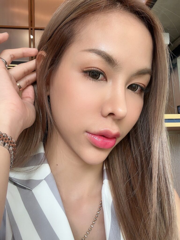 ฉีด EXOSOME ดีอย่างไร?