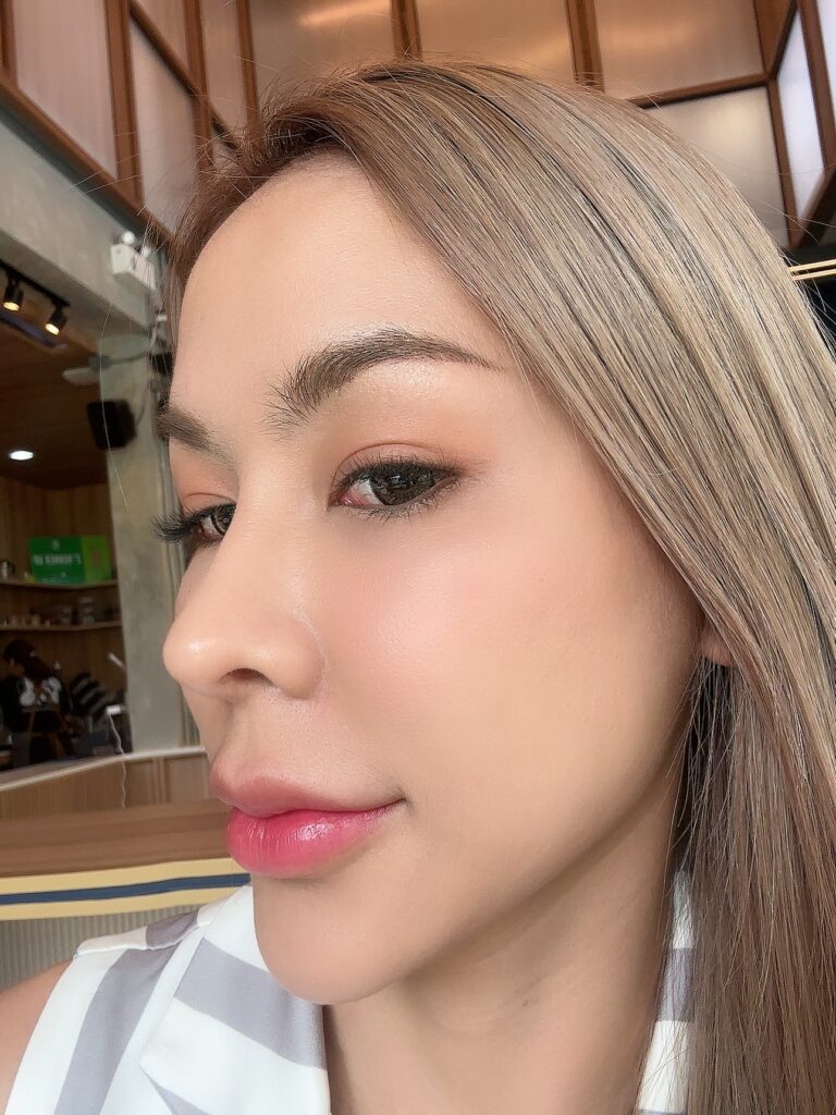 ฉีด EXOSOME ดีอย่างไร?