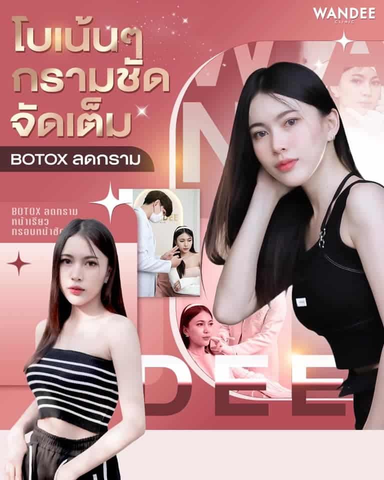 𝐁𝐨𝐭𝐨𝐱 ลดกราม