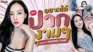 รีวิวฉีดฟิลเลอร์ปาก สายเกา จากคุณบ๊อบบี้ เปลี่ยนปากซีดให้สวยจึ้ง