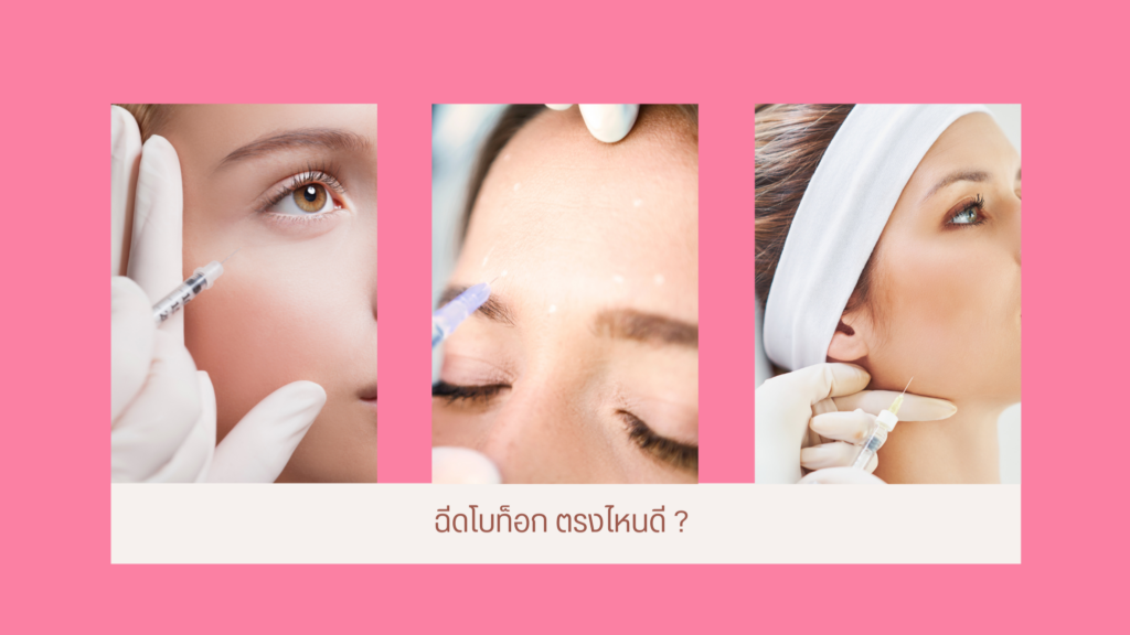 Botox คืออะไร ?