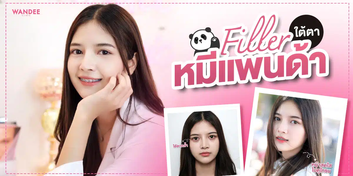 รีวิวฉีดฟิลเลอร์ใต้ตา Yvoire Filler