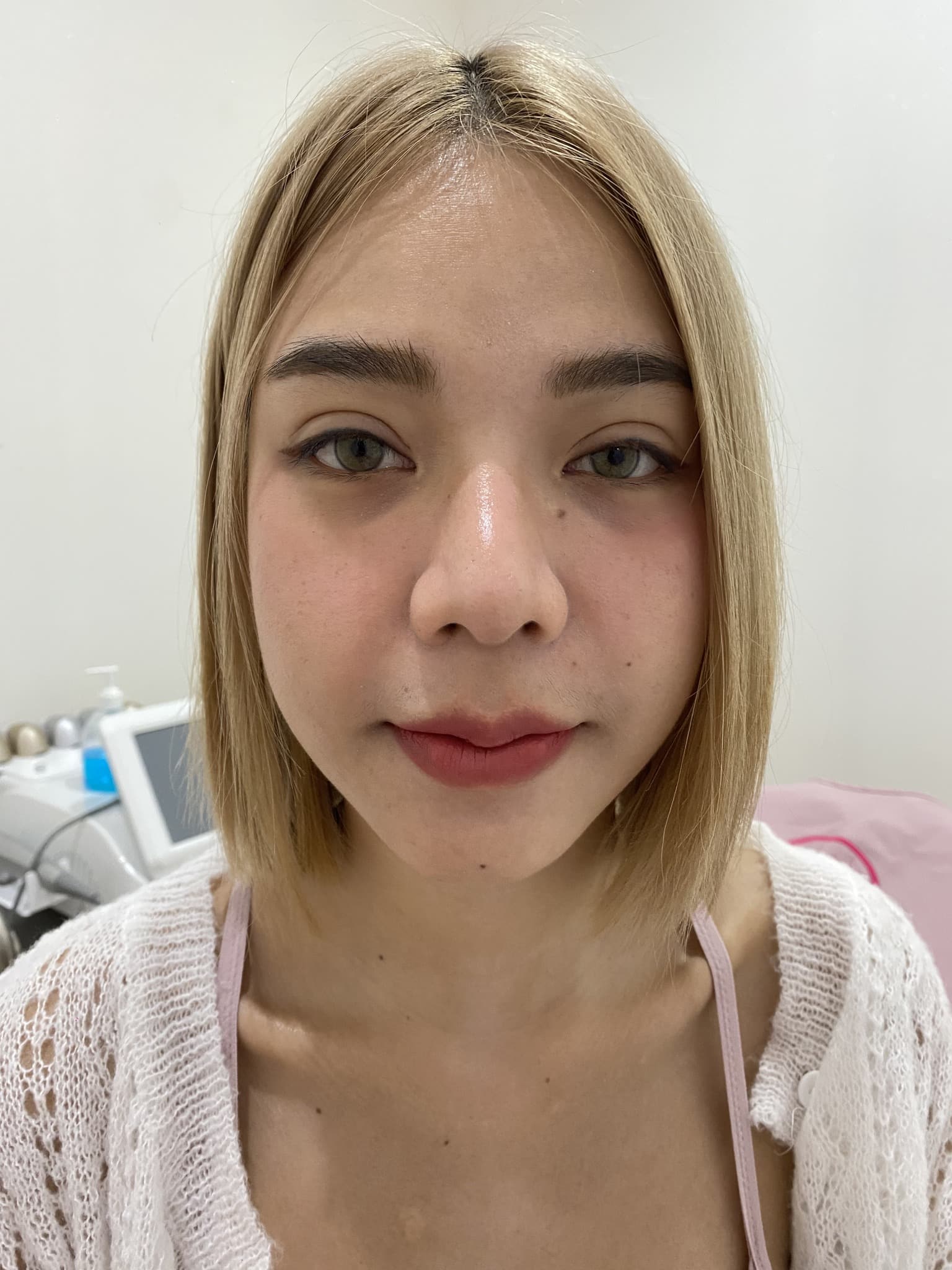 𝗙𝗜𝗟𝗟𝗘𝗥 เติมใต้ตา